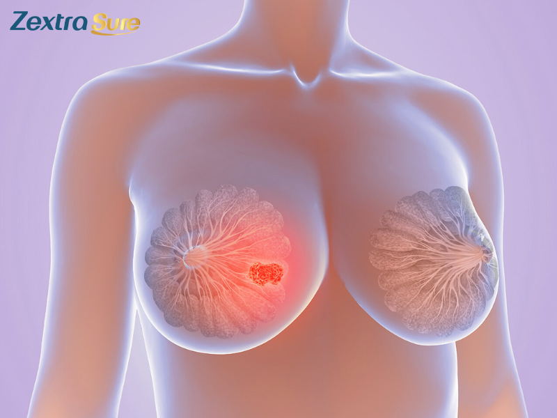 what-types-of-cancer-cause-positive-ana (3)